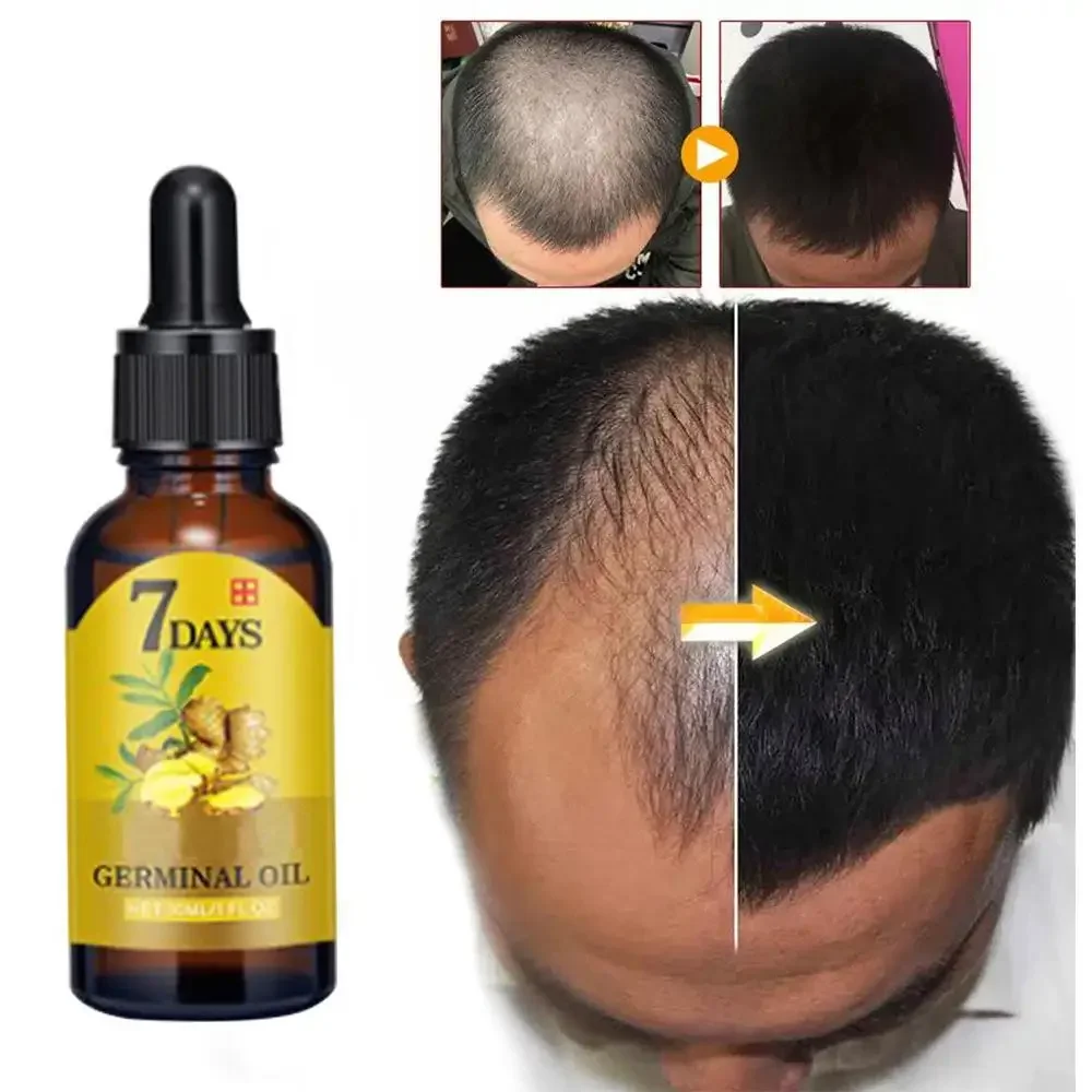 Hair Care Essence Oil Spray - Haarwachstums-Ingwer, schnell wachsendes Haar, ätherisches Öl,
