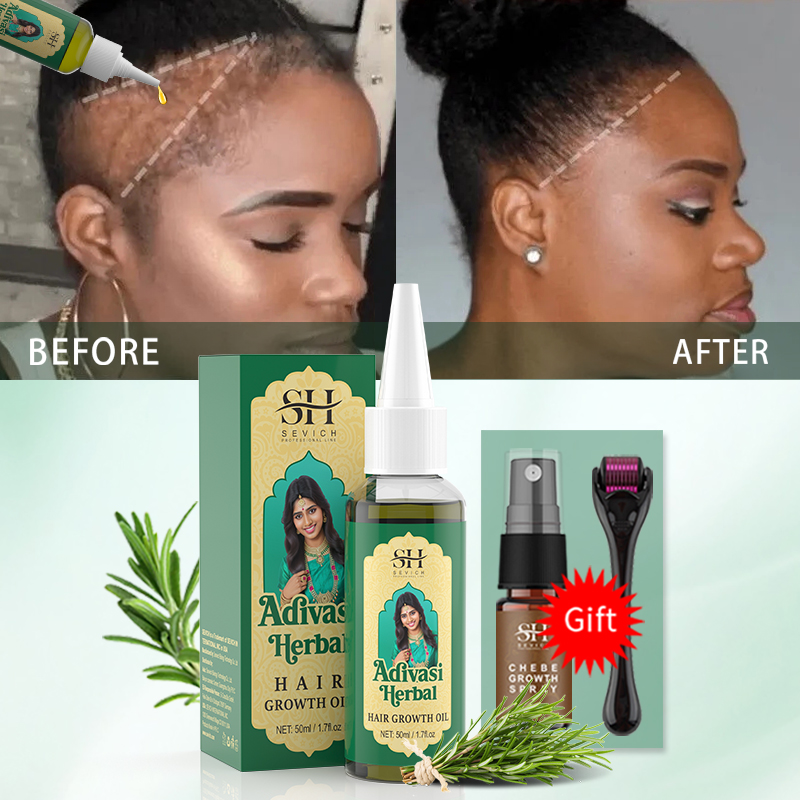 Ayurvedisches Haarwuchsöl Indi – Hair Care Essence Oil Spray Bewertung und Preis