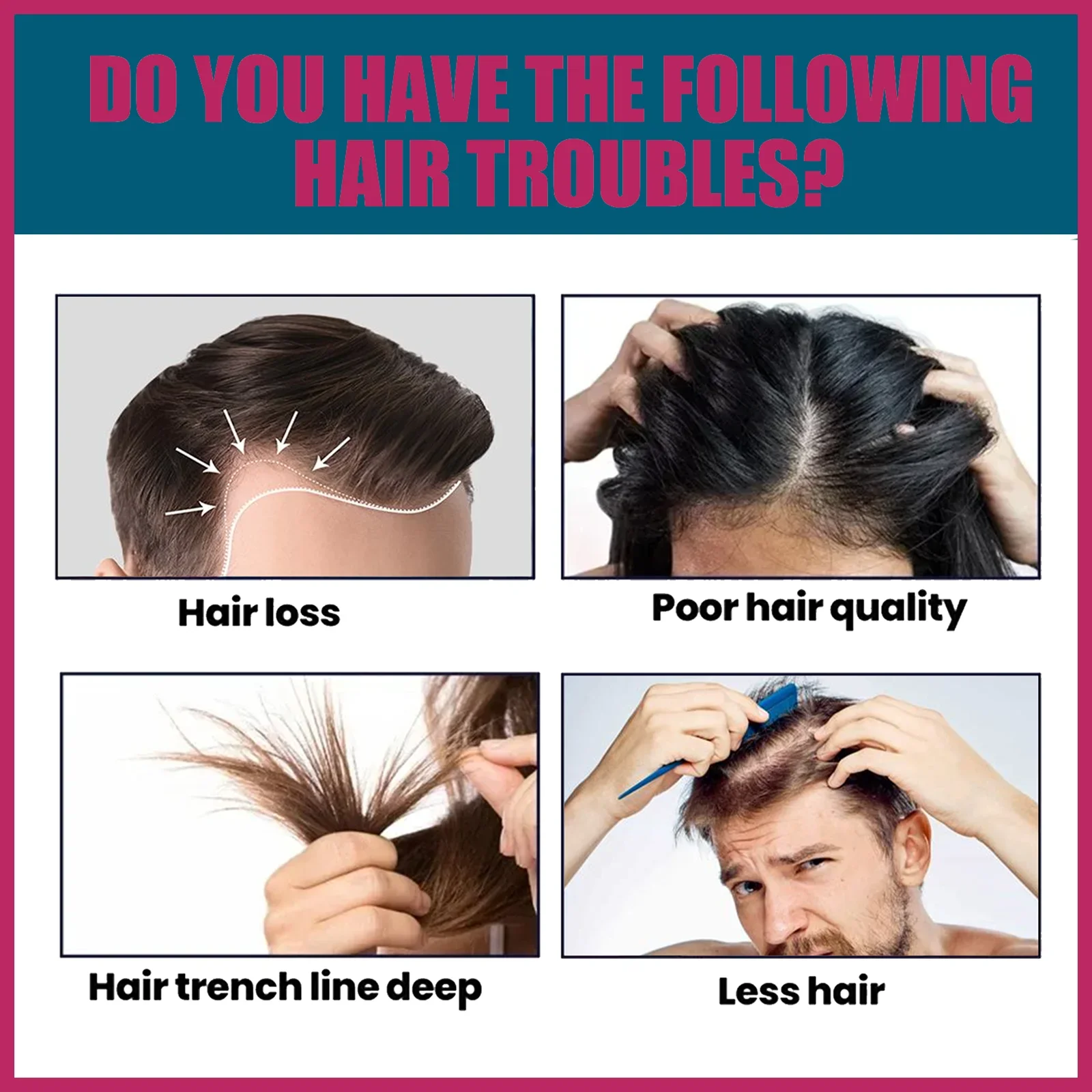 Biotin-Kollagen Haarpflege-Öl, – Hair Care Collagen Bewertung und Preis