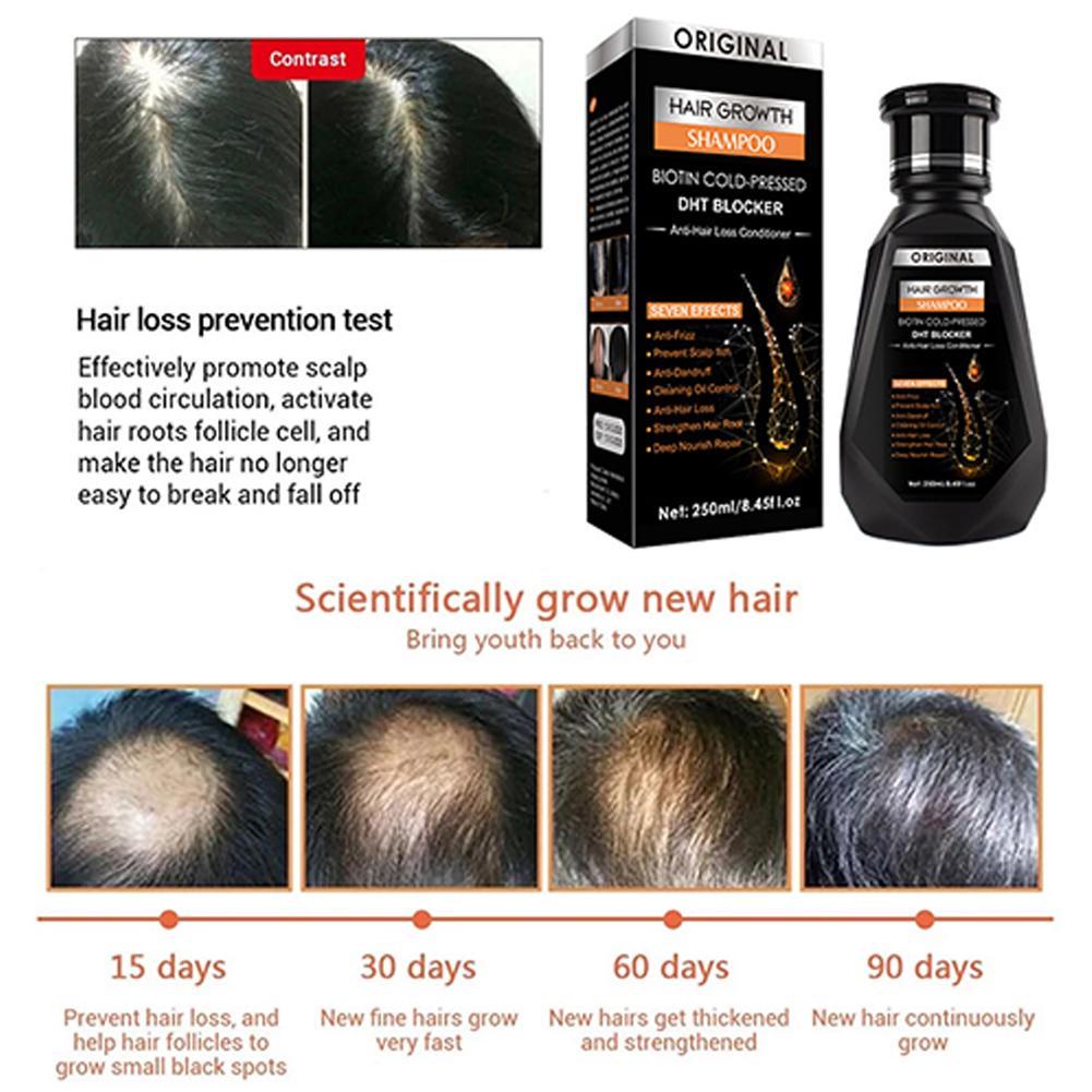 Biotin Ingwer-Shampoo, verdick – Biotin Shampoo Thickening Bewertung und Preis