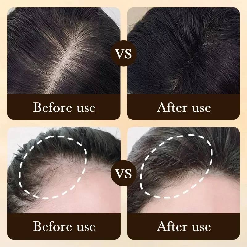 Biotin Schnelles Haarwuchsöl P – Hair Care Essence Oil Spray Bewertung und Preis