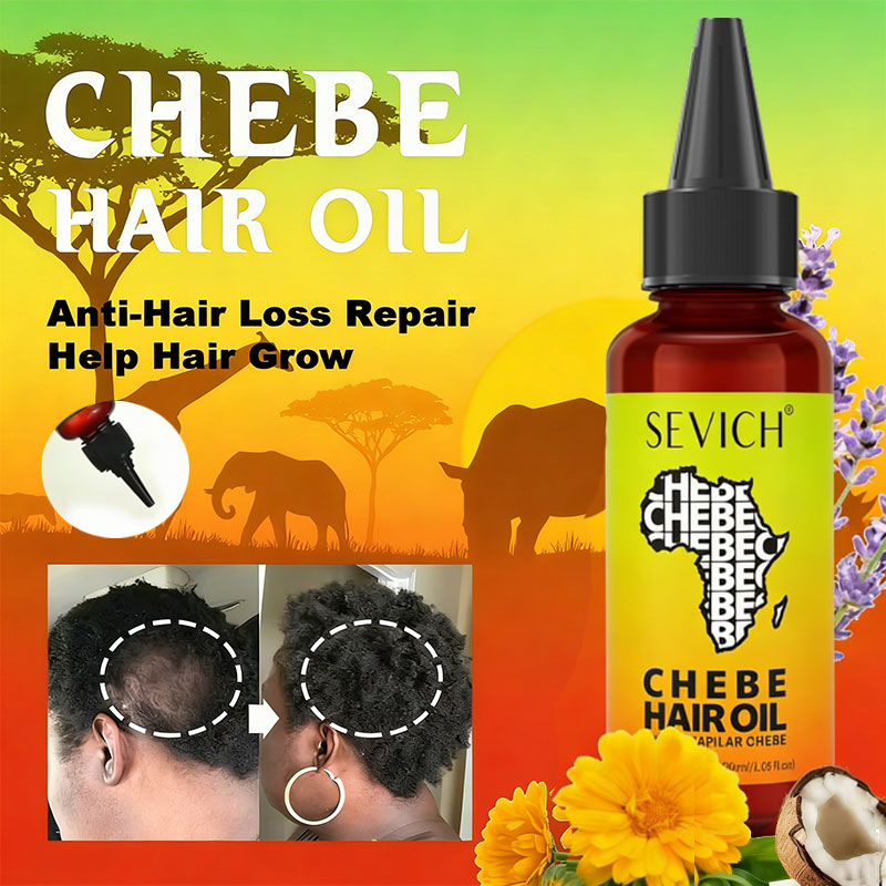 Chebe Schnelles Haarwuchsöl Af – Hair Care Essence Oil Spray Bewertung und Preis