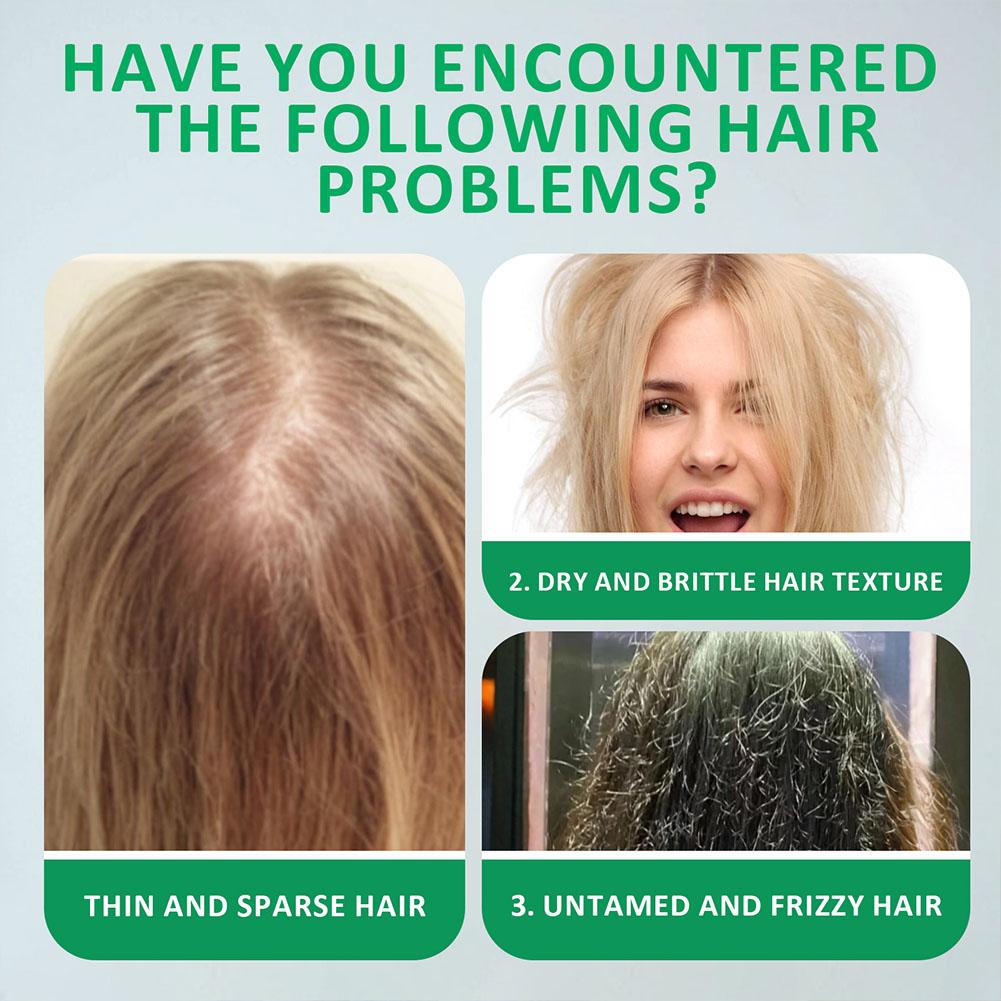 Rosmarin-Shampoo-Riegel für Ha – Biotin Shampoo Thickening Bewertung und Preis