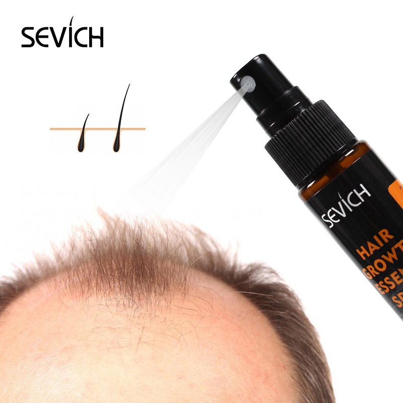 Sevich 30ml Hebal Öl Essenz Sc – Hair Care Essence Oil Spray Bewertung und Preis